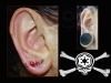 ear-lobe-1